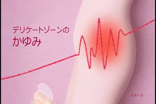 デリケートゾーンのかゆみ